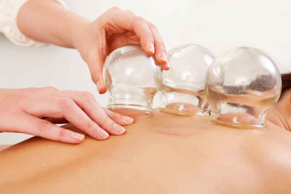 Curious About Cupping Therapy London Sportsxpress